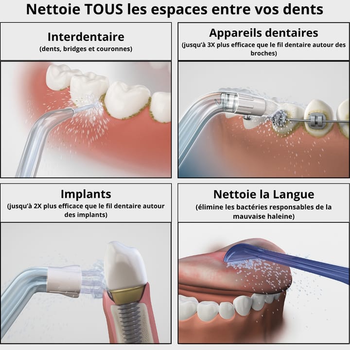 hydro-Propulseur Dentaire Pro™ Jet Dentaire Portable. Tiktok